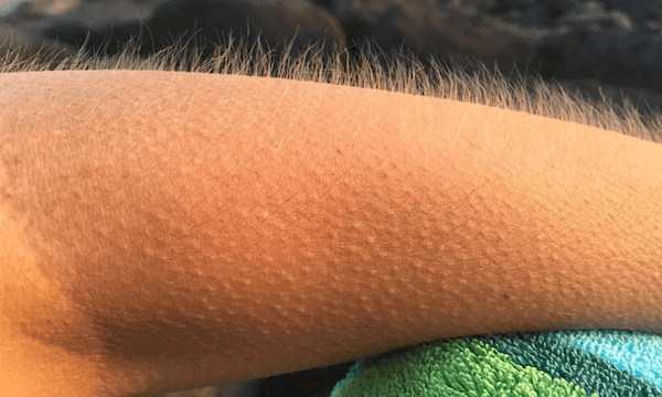 ASMR provides goosebumps